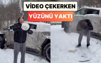 Bir Adam Soğuk Havada Sıcak Suyun Nasıl Kristalleştiğini Göstermek İsterken Yüzünü Yaktı