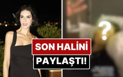 Beyin Anevrizması Geçirmişti: Apar Topar Hastaneye Kaldırılan Ahu Yağtu Son Halini Paylaştı!