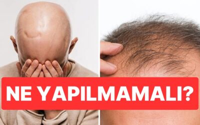Uzman İsim Saç Dökülmesini Tetikleyen En Önemli Alışkanlığı Açıkladı