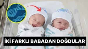 Tıp Dünyasını Hayretlere Düşüren Olay: Brezilya’da Doğan İkizlerin Farklı Babalardan Olduğu Ortaya Çıktı