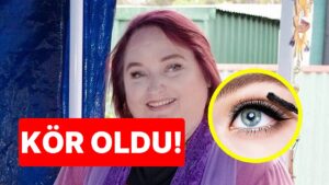 &quot;Son Kullanma Tarihi Olduğunu Bilmiyordum&quot;: 20 Yıllık Göz Kalemini Kullandığı İçin Kör Olan Kadın