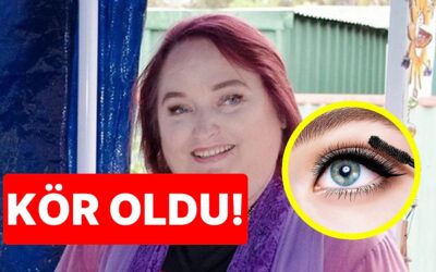 &quot;Son Kullanma Tarihi Olduğunu Bilmiyordum&quot;: 20 Yıllık Göz Kalemini Kullandığı İçin Kör Olan Kadın