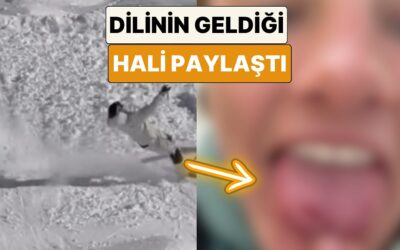 Kayak Yaparken Kaza Geçiren Bir Sporcu Ağızlık Takmadığı İçin Dilinin Geldiği Hali Paylaştı