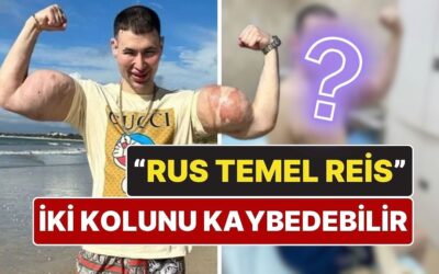 &quot;Rus Temel Reis&quot; İki Kolunu Kaybedebilir: Enjekte Ettiği Kimyasallar Hayatını Kararttı