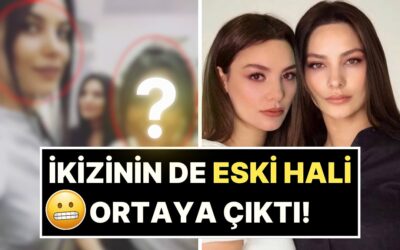 Hiç Estetiği Olmadığını Savunan Hazal Filiz Küçükköse, Bu Sefer Tek Yumurta İkizini Öne Sürmeyi Denedi!