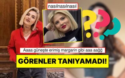 Görenler İnanamadı: Eski Kısmetse Olur Yarışmacısı Dolgularını Eritince Değişimi Gündem Oldu