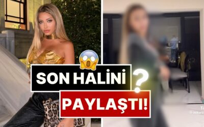 Son Halini Paylaştı: Cinsiyet Geçiş Sürecini Tamamlayan Mika Raun Bu Sefer de Poposunu Yaptırdı!