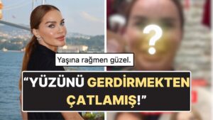 Ebru Şallı&apos;nın Filtresiz ve Photoshopsuz Hali Ortaya Çıktı: Yüzünün Son Hali Tartışma Yarattı!