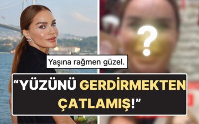 Ebru Şallı&apos;nın Filtresiz ve Photoshopsuz Hali Ortaya Çıktı: Yüzünün Son Hali Tartışma Yarattı!