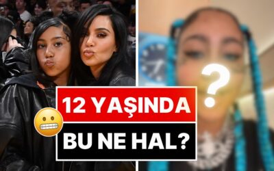 Dişlerini Siyah Metalle Kaplatan 12 Yaşındaki North West&apos;in Son Hali Akıllara Durgunluk Verdi!